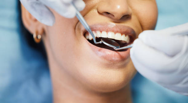 Best Emergency Root Canal Treatment in Strasburg, VA
