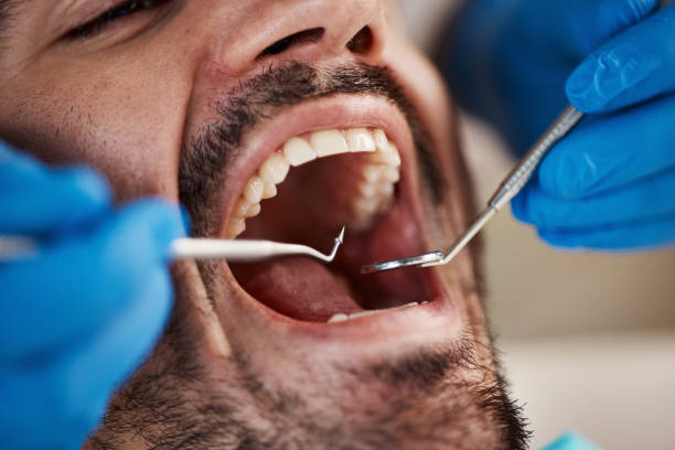 Best Emergency Treatment for Toothache in Strasburg, VA